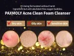 Pax Moly Acne Clean Foam Cleanser-120ml - Image 4